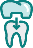 An illustration of a dental crown being placed onto a tooth with an arrow pointing down